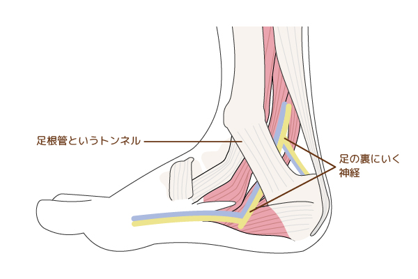 足趾や脚のしびれの原因と治療法 岐阜市の整形外科 森整形外科