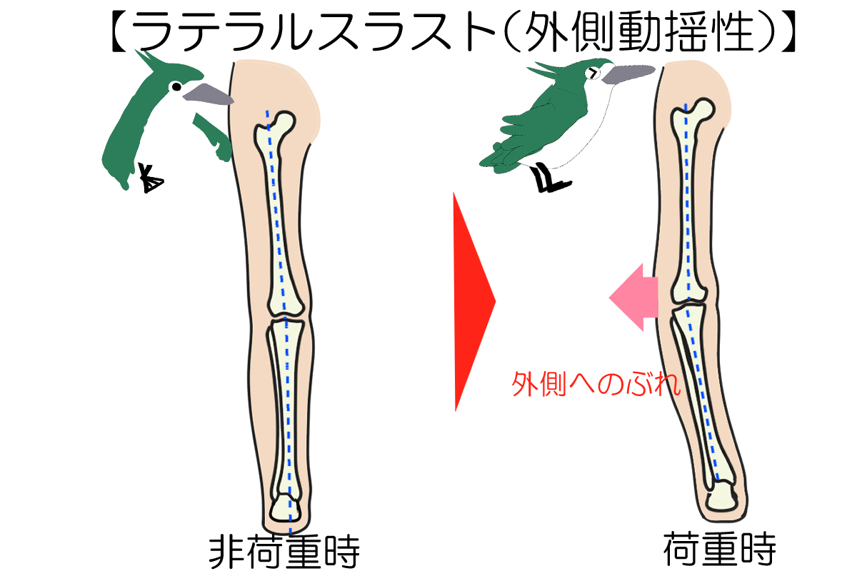 ラテラールスラスト