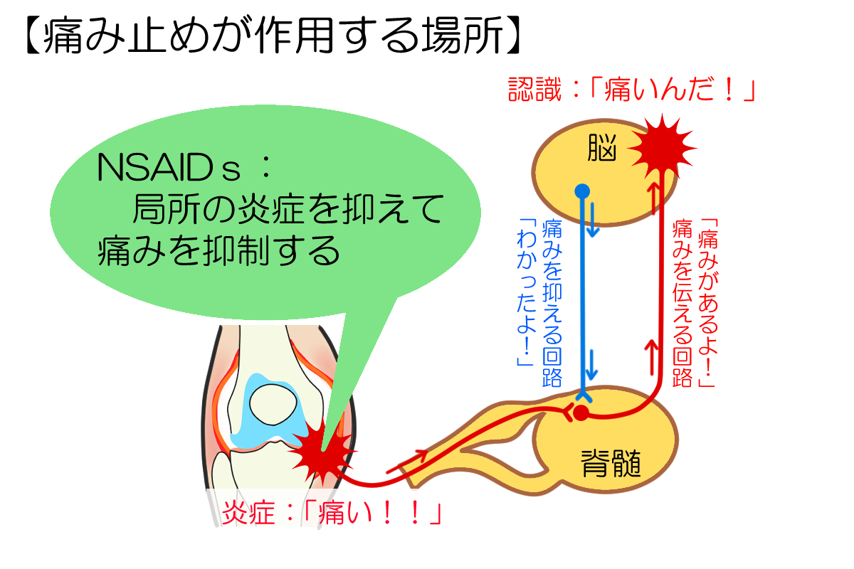 NSAIDの効果