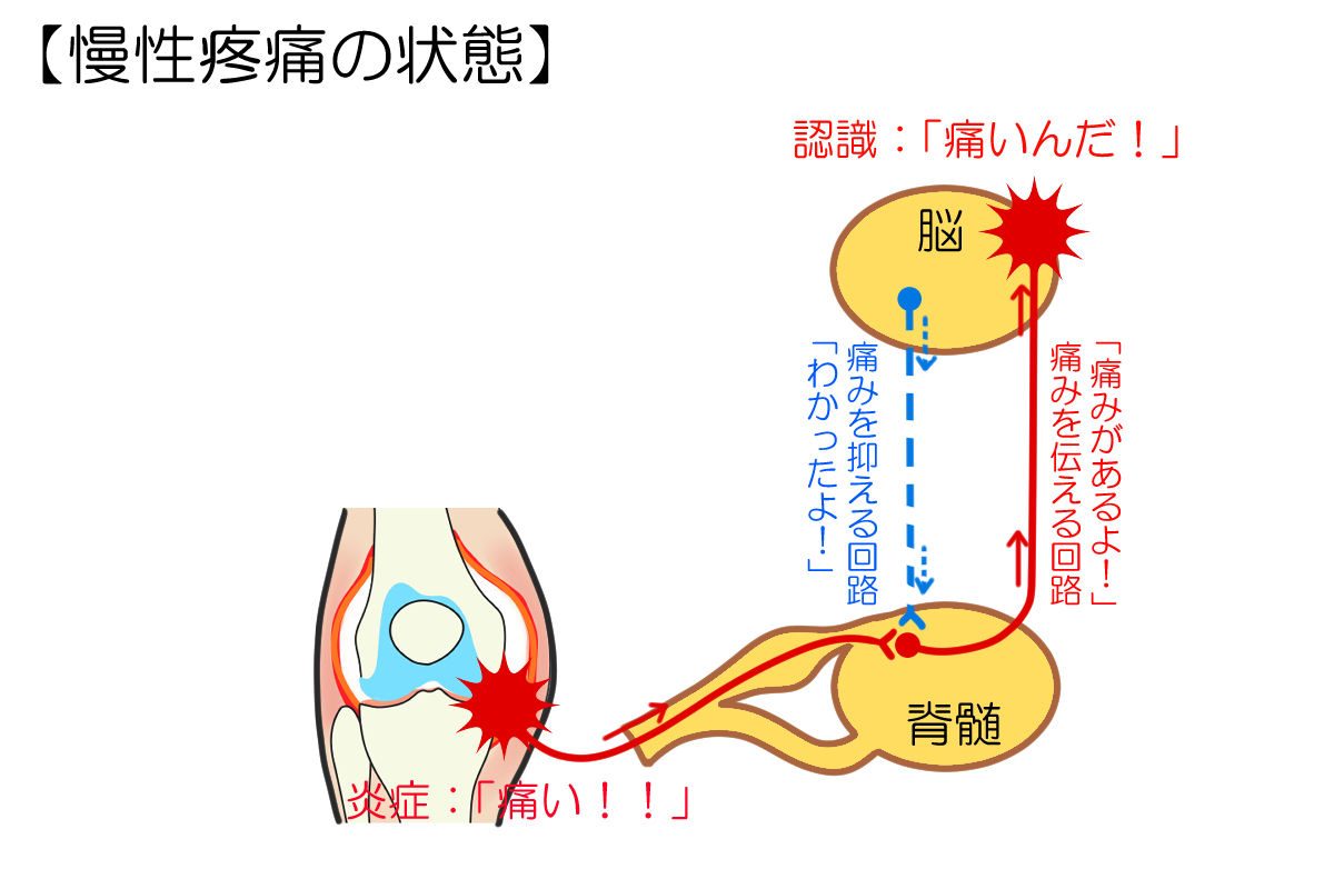 慢性疼痛の状態