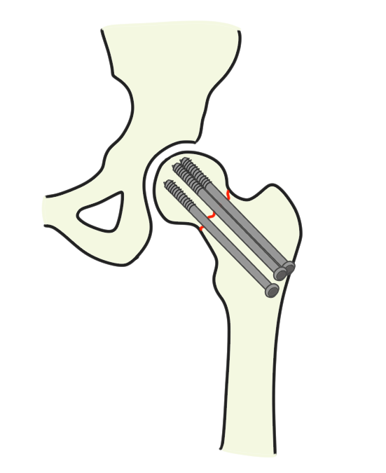 3ccdd0673414160ab3e40eae8e1c8e