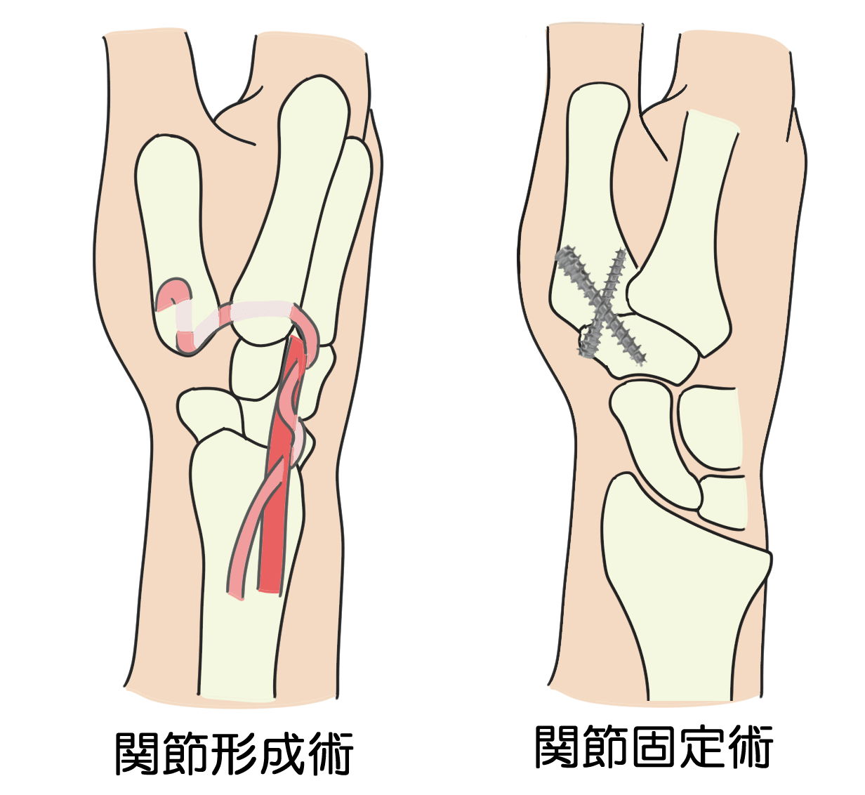 手術治療