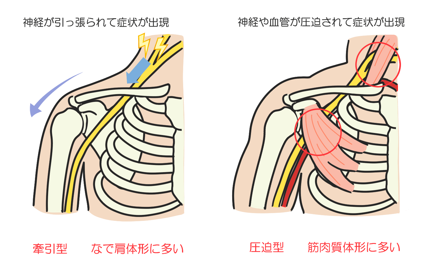 実は男性と女性で原因が違う！？<br>　　原因には2種類のタイプがあります