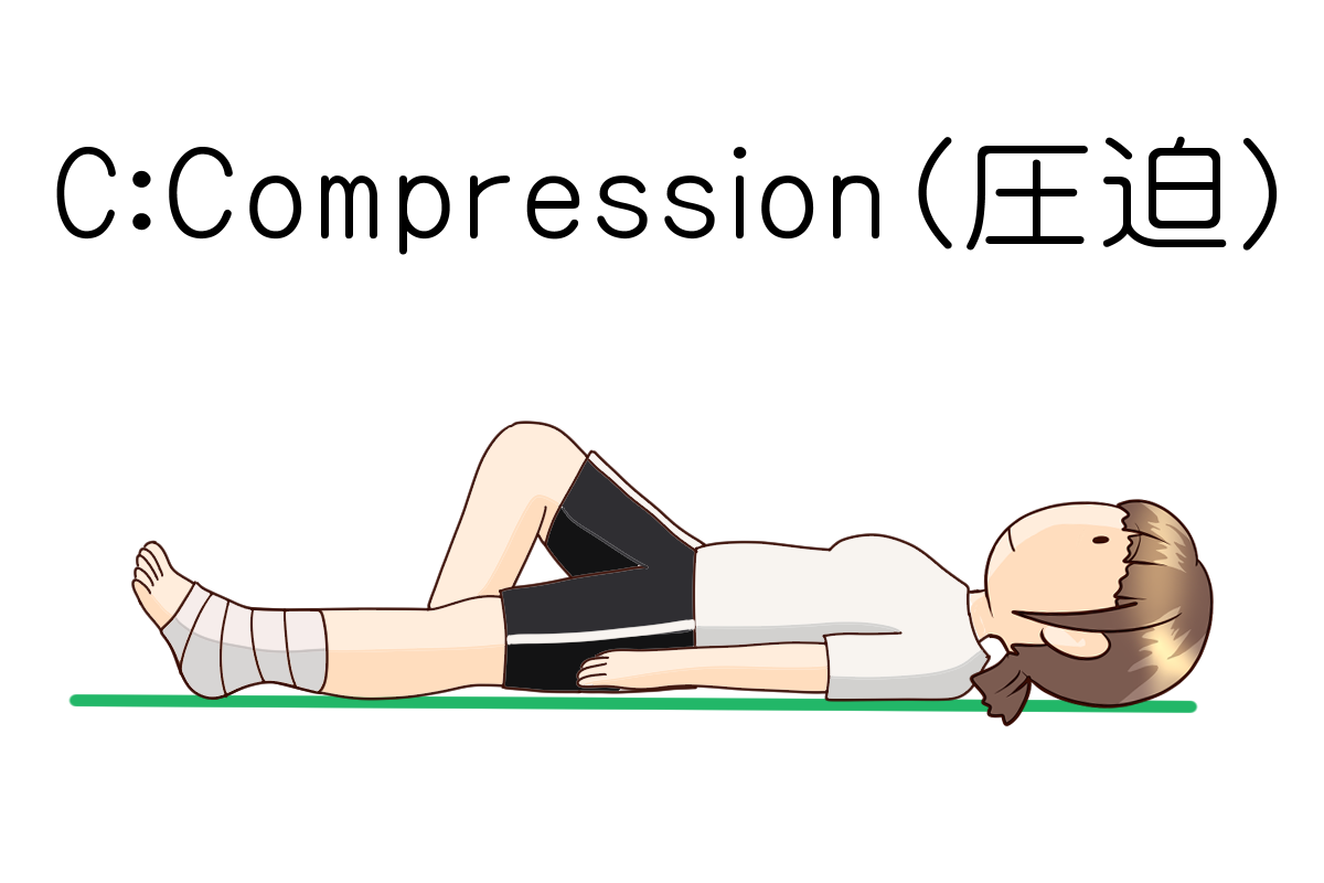 C:Compression（圧迫）