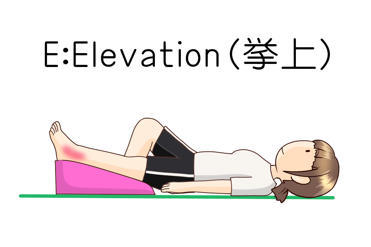 E:Elevation（挙上）