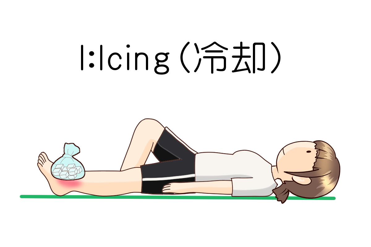 I:Icing（冷却）