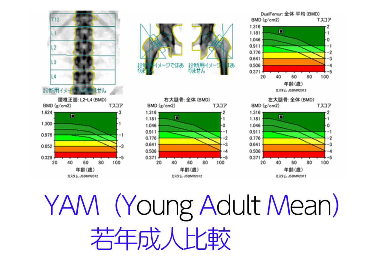 YAM値