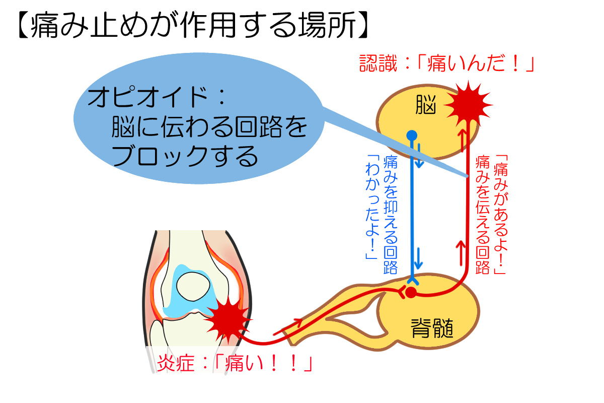 オピオイド製剤の効果