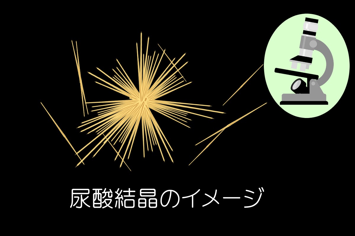 関節液検査