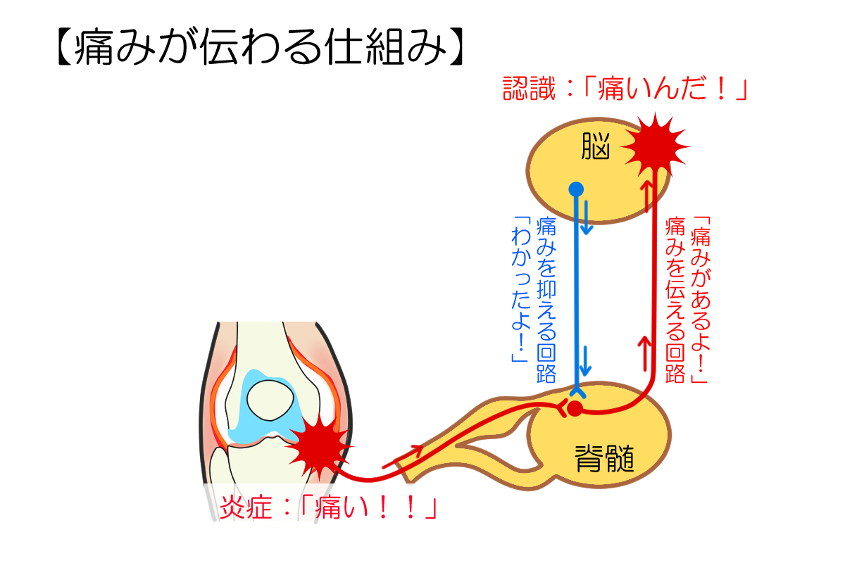 痛みが伝わる仕組み