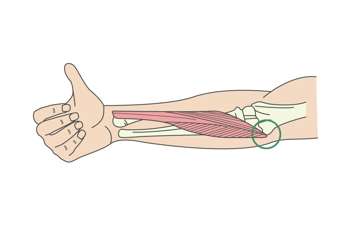 肘 の 腱 が 痛い