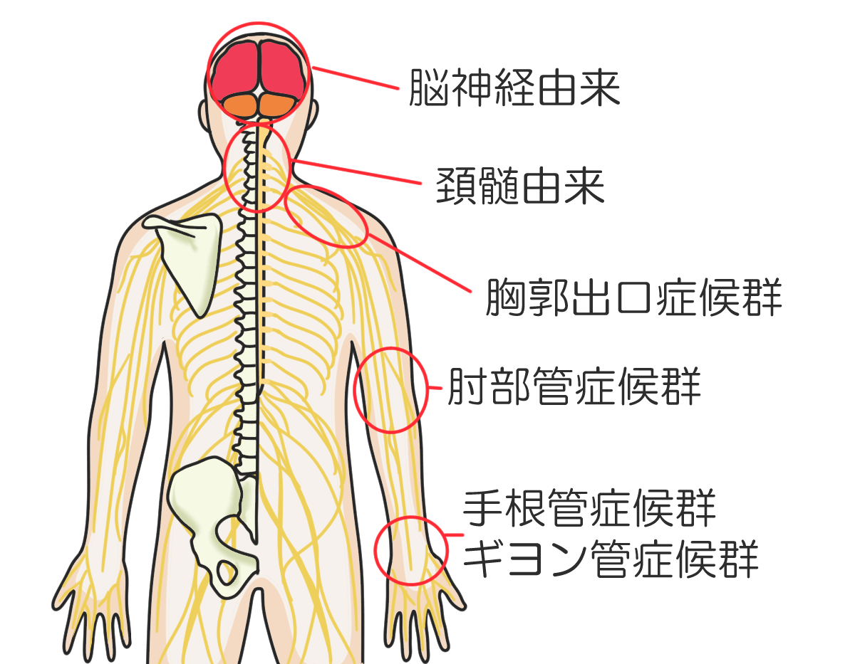 痛み 二の腕 外側 右肩の痛みや二の腕の痛みは内臓や更年期が原因？気になるお悩みを解決！