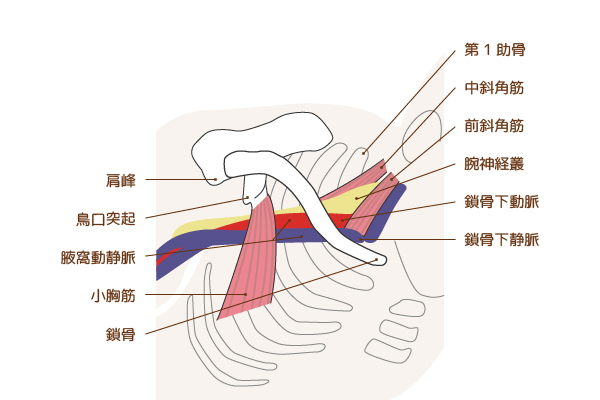 2 胸郭出口症候群