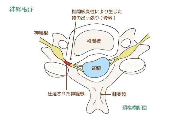 手指や腕のしびれ - 岐阜市 - 森整形外科リハビリクリニック